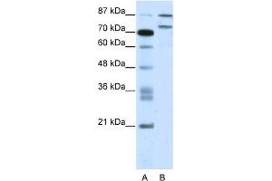 WB Suggested Anti-ZNF709 Antibody Titration:  2. (ZNF709 抗体  (N-Term))