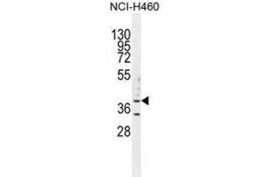 Western Blotting (WB) image for anti-UDP-Gal:betaGlcNAc beta 1,3-Galactosyltransferase, Polypeptide 5 (B3GALT5) antibody (ABIN2996041) (B3GALT5 抗体)