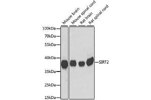Western blot analysis of extracts of various cell lines, using SIRT2 antibody. (SIRT2 抗体)