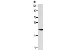 Western Blotting (WB) image for anti-TNFAIP3 Interacting Protein 2 (TNIP2) antibody (ABIN2427435) (TNIP2 抗体)