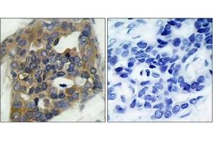 Image no. 1 for anti-Mitogen-Activated Protein Kinase Kinase Kinase 5 (MAP3K5) (pSer966) antibody (ABIN196915) (ASK1 抗体  (pSer966))
