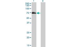 Western Blotting (WB) image for anti-A Kinase (PRKA) Anchor Protein 10 (AKAP10) (AA 1-101) antibody (ABIN599175) (AKAP10 抗体  (AA 1-101))