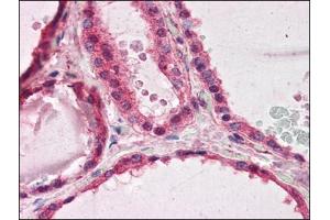 Human Thyroid (formalin-fixed, paraffin-embedded) stained with PAFAH1B1at 3. (PAFAH1B1 抗体  (C-Term))