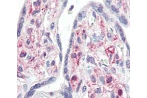 IHC analysis of FFPE human placenta tissue stained with IRAK antibody (IRAK1 抗体  (AA 683-712))