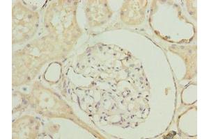 Immunohistochemistry of paraffin-embedded human kidney tissue using ABIN7170672 at dilution of 1:100 (SLA 抗体  (AA 2-276))