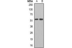 Western blot analysis of MPP1 expression in Jurkat (A), mouse kidney (B) whole cell lysates. (MPP1 抗体)