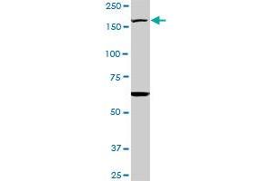 Western Blotting (WB) image for anti-Lysine (K)-Specific Demethylase 5B (KDM5B) (AA 231-319) antibody (ABIN1327126)