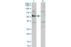 Western Blot analysis of CNDP2 expression in transfected 293T cell line by CNDP2 monoclonal antibody (M09), clone 1B1.