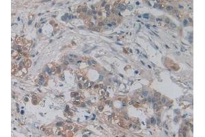 Immunohistochemistry (IHC) image for anti-Pyruvate Kinase M2 (PKM2) (AA 294-470) antibody (ABIN7438913)