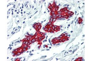 Anti-Cytokeratin 19 antibody IHC of human breast. (Cytokeratin 19 抗体)