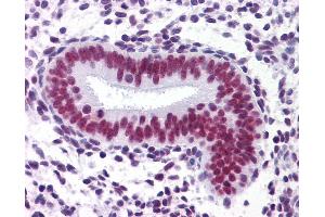 Anti-CHD4 antibody IHC of human uterus.