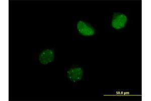 Immunofluorescence of purified MaxPab antibody to SUMO4 on HeLa cell. (SUMO4 抗体  (AA 1-95))
