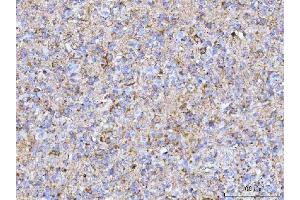 IHC analysis of PTN using anti-PTN antibody (ABIN7602164). (Pleiotrophin 抗体  (AA 61-148))