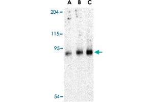 Western blot analysis of TRPC6 in mouse lung tissue lysate with TRPC6 polyclonal antibody  at (A) 0. (TRPC6 抗体  (C-Term))