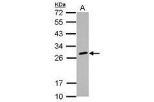 Image no. 2 for anti-Major Histocompatibility Complex, Class II, DQ beta 2 (HLA-DQB2) antibody (ABIN1498674) (HLA-DQB2 抗体)