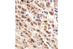 Immunohistochemical analysis of paraffin-embedded H. (Dihydrofolate Reductase 抗体  (N-Term))