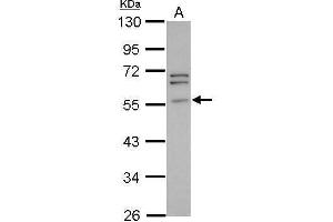 WB Image Sample (30 ug of whole cell lysate) A: PC-3 10% SDS PAGE antibody diluted at 1:1000 (Peripherin 抗体)