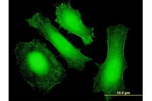Immunofluorescence of purified MaxPab antibody to LIN28 on HeLa cell. (LIN28A 抗体  (AA 1-209))