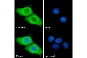 (ABIN238610) Immunofluorescence analysis of paraformaldehyde fixed A431 cells, permeabilized with 0.