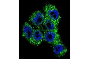 Confocal immunofluorescent analysis of TRPM8 Antibody (Center) with A375 cell followed by Alexa Fluor 488-conjugated goat anti-rabbit lgG (green). (TRPM8 抗体  (Middle Region))