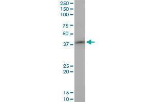Western Blotting (WB) image for anti-serine/threonine/tyrosine Kinase 1 (STYK1) (AA 50-159) antibody (ABIN527521)