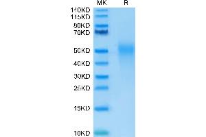 IL18BP Protein (AA 31-194) (His tag)