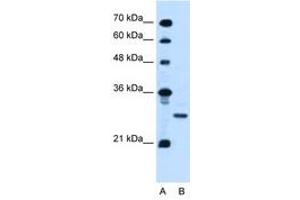 Image no. 1 for anti-Podoplanin (PDPN) (AA 97-146) antibody (ABIN6736674) (Podoplanin 抗体  (AA 97-146))