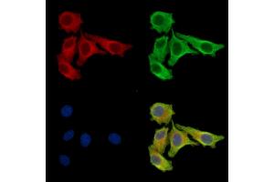 ABIN7097105 and ABIN7101172 staining Hela cells by IF/ICC. (Chromosome 7 Open Reading Frame 20 (C7orf20) 抗体)
