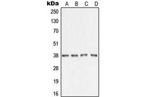 Western blot analysis of AMD1 expression in A431 (A), HepG2 (B), SP2/0 (C), H9C2 (D) whole cell lysates. (AMD1 抗体  (Center))