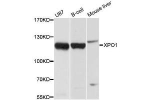 Western blot analysis of extracts of various cell lines, using XPO1 antibody. (XPO1 抗体  (C-Term))