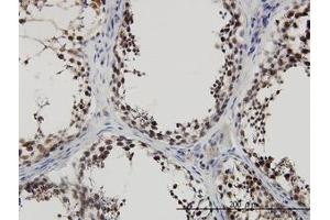 Image no. 3 for anti-PDZ Binding Kinase (PBK) (AA 1-110) antibody (ABIN599275) (PBK 抗体  (AA 1-110))