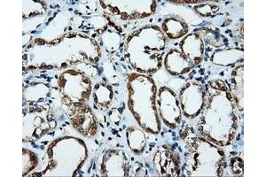 Immunohistochemical staining of paraffin-embedded Kidney tissue using anti-PLEK mouse monoclonal antibody. (Pleckstrin 抗体)