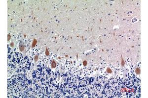 Immunohistochemistry (IHC) analysis of paraffin-embedded Human Brain, antibody was diluted at 1:100. (KIR3DL1 抗体)