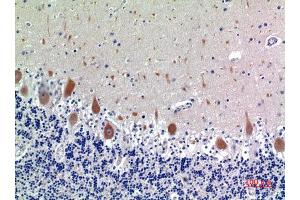 Immunohistochemistry (IHC) analysis of paraffin-embedded Human Brain, antibody was diluted at 1:100. (KIR3DL1 抗体)