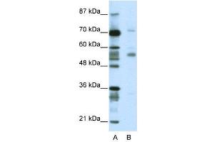 Western Blotting (WB) image for anti-Coronin, Actin Binding Protein, 1A (CORO1A) (N-Term) antibody (ABIN2780826)