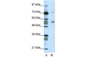 WB Suggested Anti-CORO1A  Antibody Titration: 2. (Coronin 1a 抗体  (N-Term))