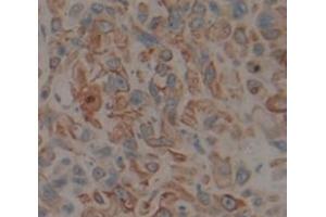 IHC-P analysis of Human Tissue, with DAB staining. (CYP1A1 抗体  (AA 1-250))