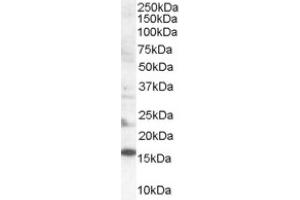 Image no. 1 for anti-SH2 Domain Containing 1A (SH2D1A) (Internal Region) antibody (ABIN374629) (SH2D1A 抗体  (Internal Region))