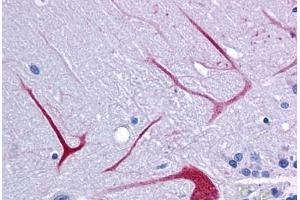 Anti-BANP antibody IHC staining of human brain, cerebellum. (BANP 抗体  (Internal Region))