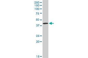 CA12 MaxPab rabbit polyclonal antibody. (CA12 抗体  (AA 1-354))