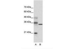 Image no. 1 for anti-Hairy and Enhancer of Split 4 (HES4) (N-Term) antibody (ABIN202082) (HES4 抗体  (N-Term))