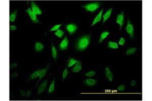 Immunofluorescence of monoclonal antibody to TESK2 on HeLa cell. (TESK2 抗体  (AA 405-542))