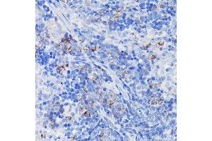 Immunohistochemistry of paraffin-embedded rat spleen using Clusterin alpha chain Rabbit pAb (ABIN6133477, ABIN6138756, ABIN6138758 and ABIN6216721) at dilution of 1:100 (40x lens). (Clusterin 抗体  (AA 23-120))