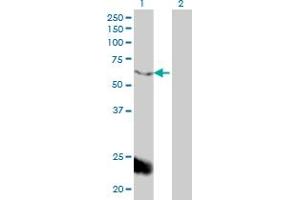 Western Blot analysis of PPARBP expression in transfected 293T cell line by PPARBP monoclonal antibody (M01), clone 2A2. (MED1 抗体  (AA 1391-1490))