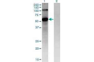 Western Blot analysis of FZD4 expression in transfected 293T cell line by FZD4 monoclonal antibody (M02), clone 3G7. (FZD4 抗体  (AA 107-206))