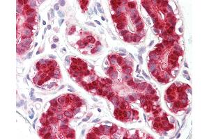 Anti-RIG-1 / RIG-I antibody IHC of human breast. (DDX58 抗体  (AA 200-250))
