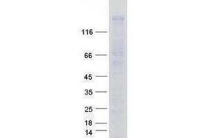 Validation with Western Blot