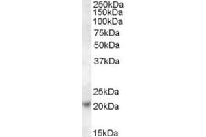 ABIN238604 (1µg/ml) staining of Jurkat cell lysate (35µg protein in RIPA buffer). (ASF1A 抗体  (C-Term))