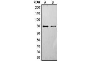 Western blot analysis of Frizzled 6 expression in HT29 (A), HeLa (B) whole cell lysates. (FZD6 抗体  (Center))