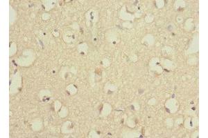 Immunohistochemistry of paraffin-embedded human brain tissue using ABIN7142540 at dilution of 1:100 (RPS27 抗体  (AA 1-84))